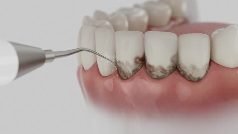 Trusted Root Canal Treatment service in Portland, TN - Dentist Open Now